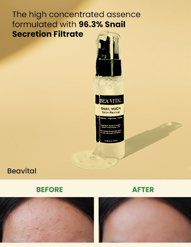Advanced Snail Mucin Skin Revival 96% | Hydration & Skin Renewal